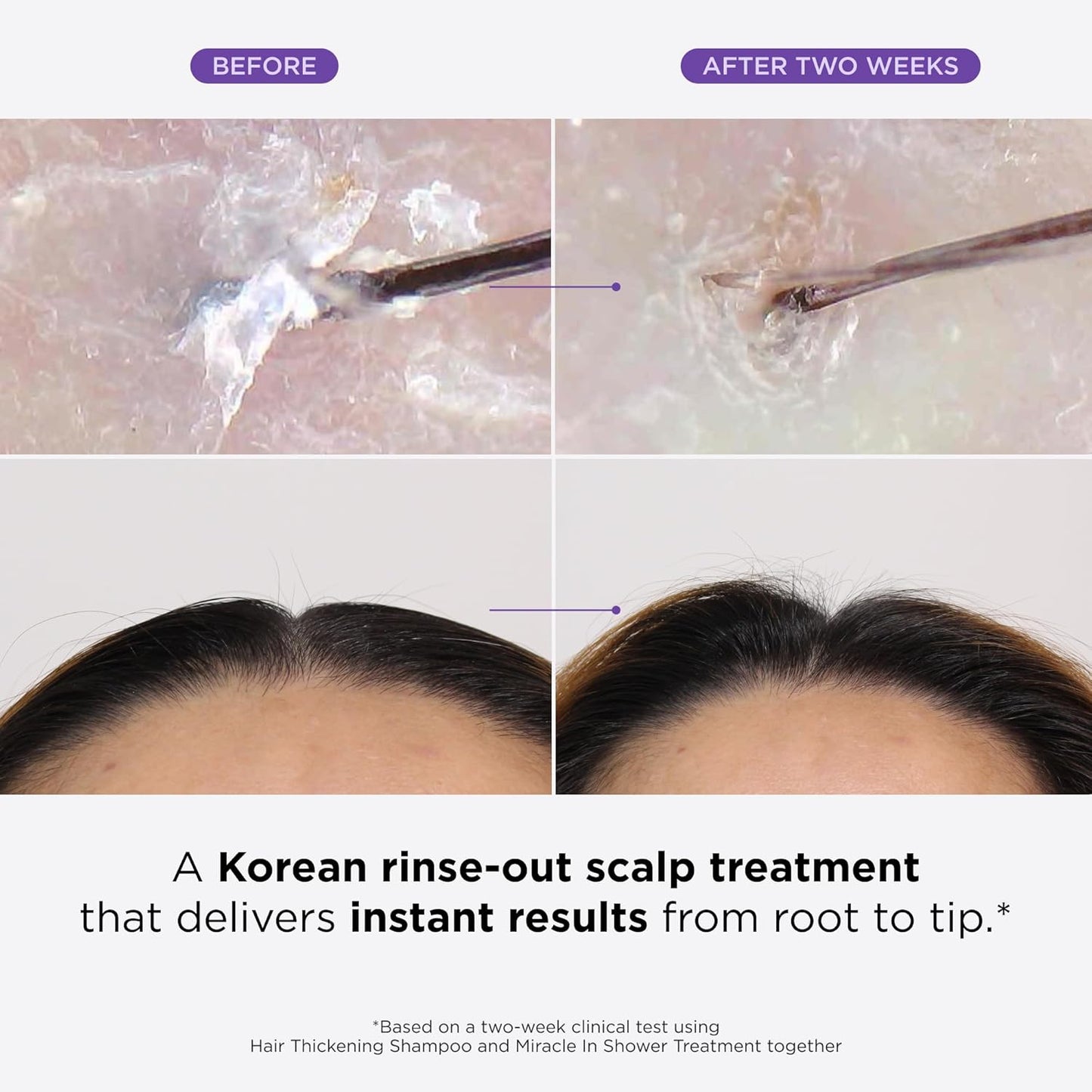 Dr. Groot Miracle in Shower Treatment - product detail image 2