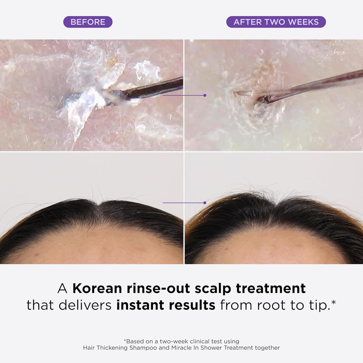 Dr. Groot Miracle in Shower Treatment - product detail image 2