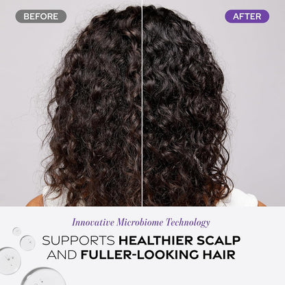 Dr. Groot Scalp Revitalizing Solution Scalp Exfoliating Detox Water - product detail image 6